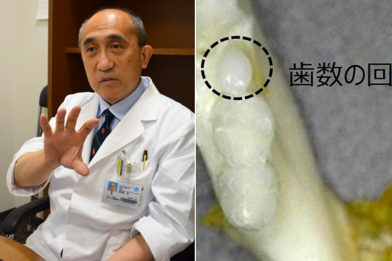 Jaw-Dropping Japenese Drug That Regrows Teeth Could Kill Off Dentures & Implants Forever