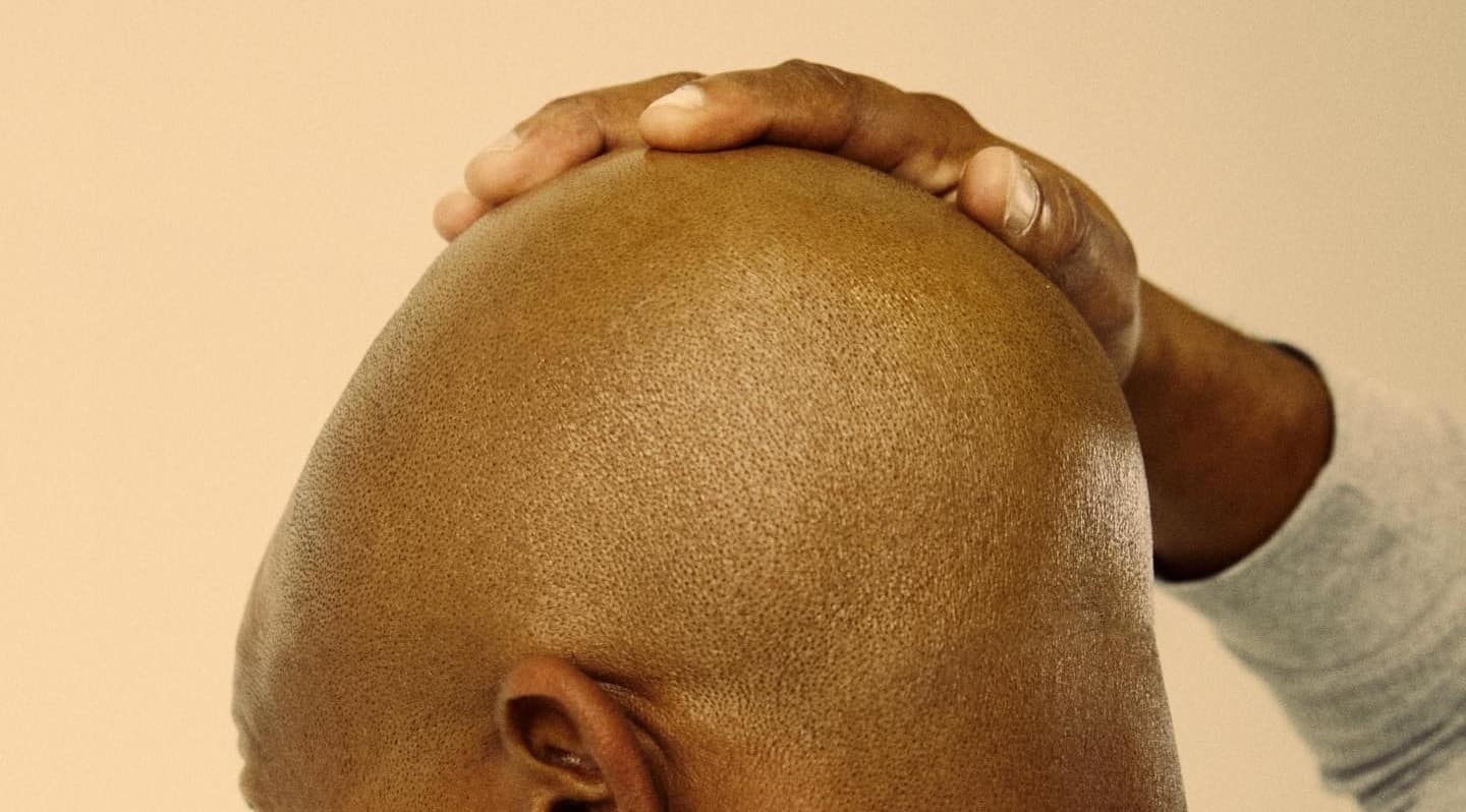 7 Bald Head Care Steps – How To Maintain Your Scalp in 2024