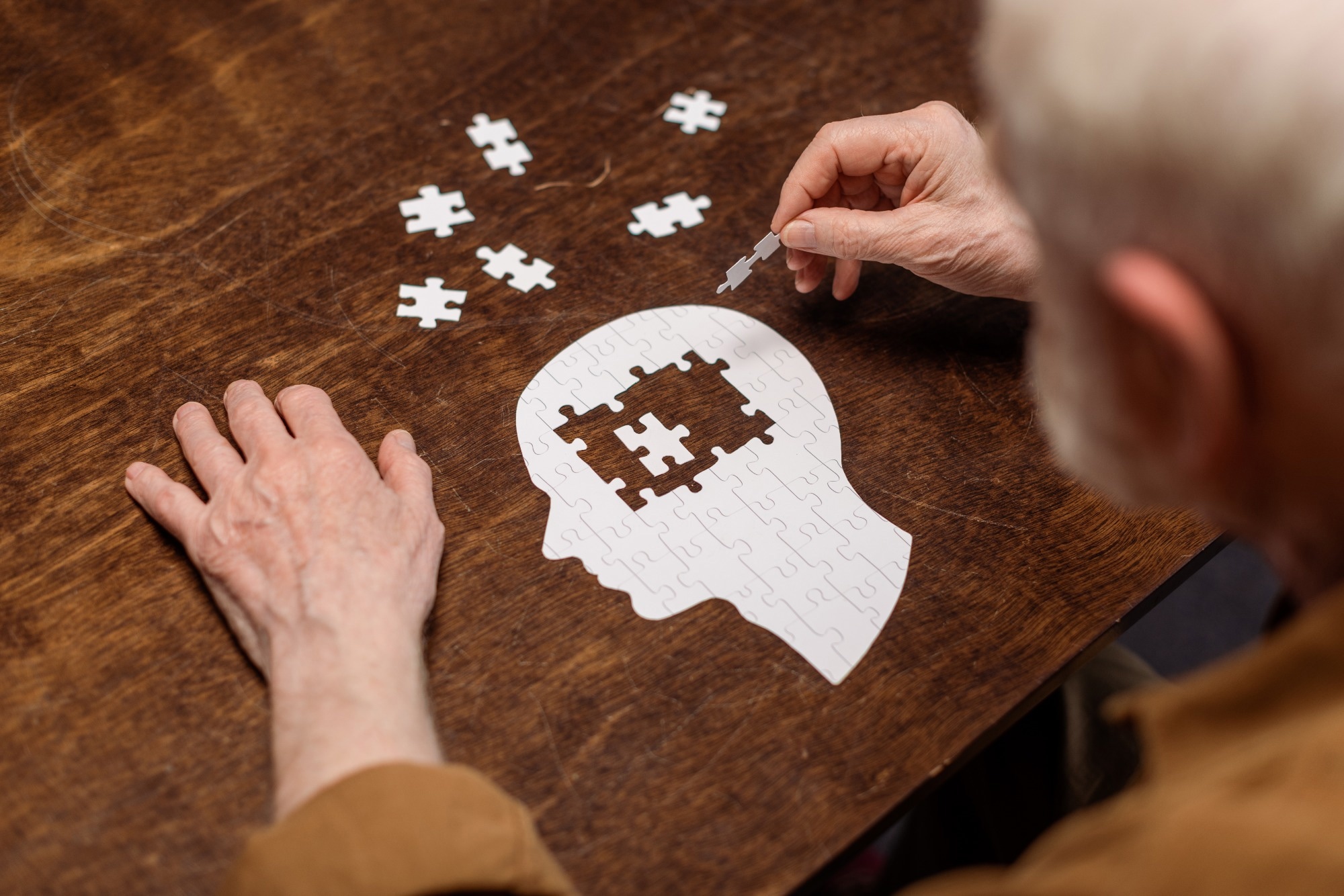 Is posttraumatic epilepsy associated with long-term dementia risk?