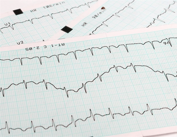 Mayo Clinic pioneers use of pulsed field ablation to treat atrial fibrillation